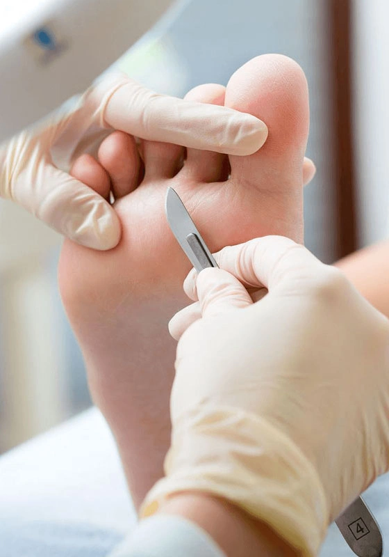 Grupo Médico Quirúrgico CANADI Especialistas en pie diabético heridas crónicas y várices