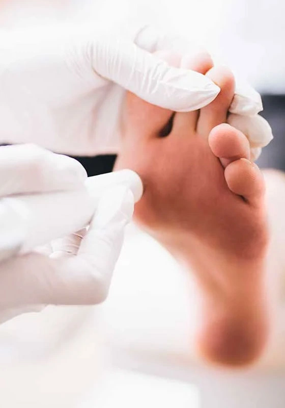 Grupo Médico Quirúrgico CANADI Especialistas en pie diabético heridas crónicas y várices