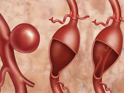 Grupo Médico Quirúrgico CANADI Especialistas en pie diabético heridas crónicas y várices