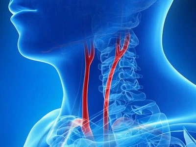 Grupo Médico Quirúrgico CANADI Especialistas en pie diabético heridas crónicas y várices