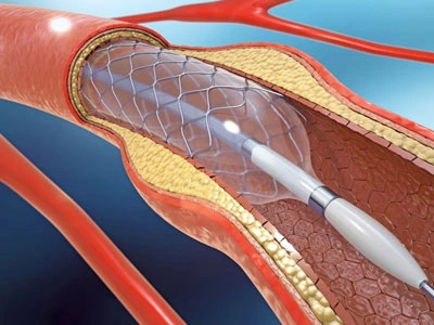 Grupo Médico Quirúrgico CANADI Especialistas en pie diabético heridas crónicas y várices