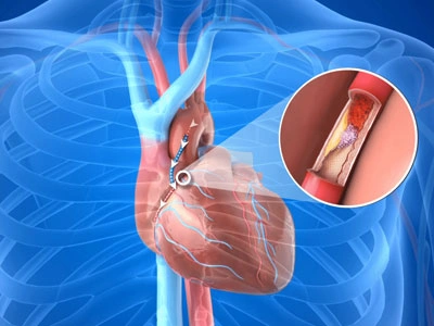 Grupo Médico Quirúrgico CANADI Especialistas en pie diabético heridas crónicas y várices