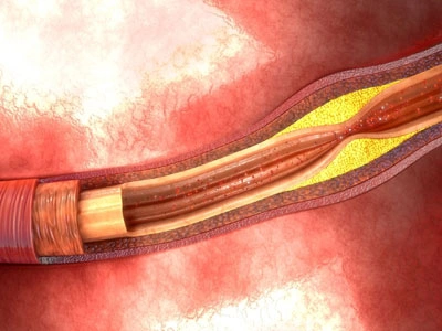 Grupo Médico Quirúrgico CANADI Especialistas en pie diabético heridas crónicas y várices