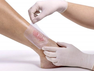 Grupo Médico Quirúrgico CANADI Especialistas en pie diabético heridas crónicas y várices