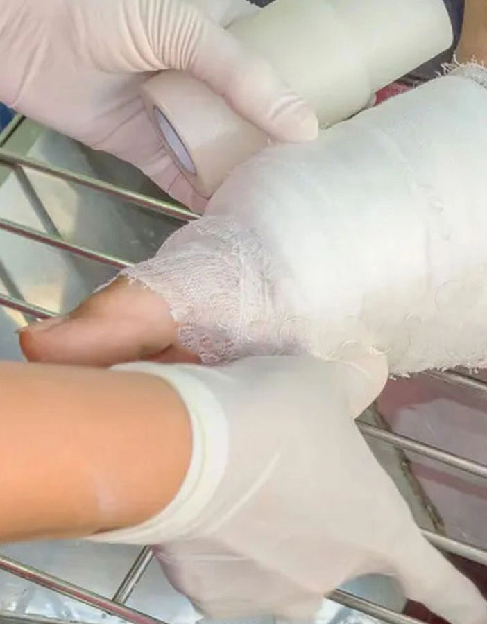 Grupo Médico Quirúrgico CANADI Especialistas en pie diabético heridas crónicas y várices