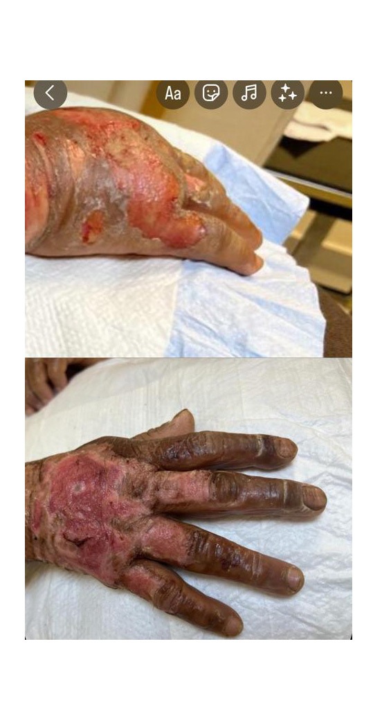 Grupo Médico Quirúrgico CANADI Especialistas en pie diabético heridas crónicas y várices