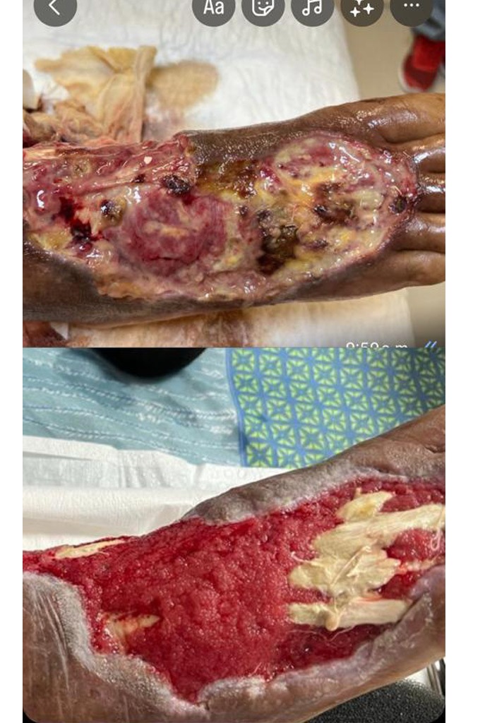 Grupo Médico Quirúrgico CANADI Especialistas en pie diabético heridas crónicas y várices